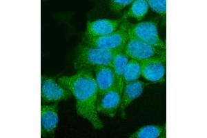 IF analysis of Utrophin/UTRN using anti-Utrophin/UTRN antibody (ABIN7599842).