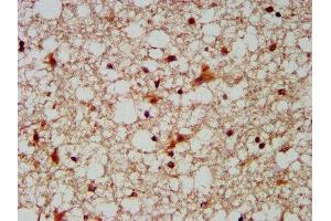IHC image of ABIN7148695 diluted at 1:300 and staining in paraffin-embedded human brain tissue performed on a Leica BondTM system. (MUS81 antibody  (AA 82-265))