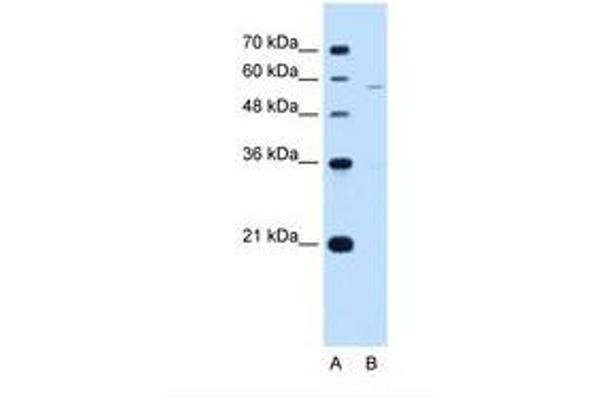 PIGV Antikörper  (AA 51-100)