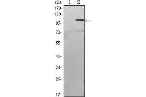 TAB2 antibody