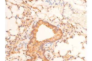 ABIN6267289 at 1/100 staining mouse lung tissue sections by IHC-P.