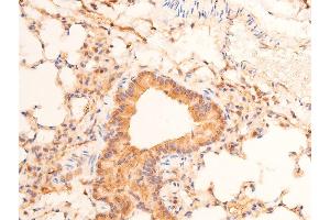 ABIN6267289 at 1/100 staining mouse lung tissue sections by IHC-P. (p53 antibody  (pSer15))