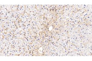 Detection of ICAM1 in Human Liver Tissue using Monoclonal Antibody to Intercellular Adhesion Molecule 1 (ICAM1) (ICAM1 antibody  (AA 41-464))