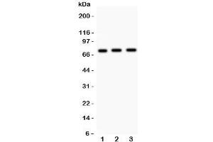 Western blot testing of Myb antibody and human samples 1:  placenta;  2: SMMC-7721;  3: HeLa lysate. (MYB antibody  (AA 1-201))
