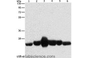Western blot analysis of Human fetal muscle and fetal lung tissue, Human leiomyosarcoma tissue, mouse lung and heart tissue,  NIH/3T3 cell, using CAV1 Polyclonal Antibody at dilution of 1:550 (Caveolin-1 antibody)