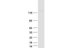 Validation with Western Blot (PSD3 Protein (Transcript Variant 1) (Myc-DYKDDDDK Tag))