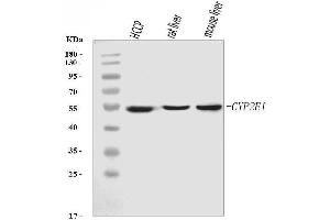 Western blot analysis of Cytochrome P450 2E1/CYP2E1 using anti-Cytochrome P450 2E1/CYP2E1 antibody (ABIN7601447).