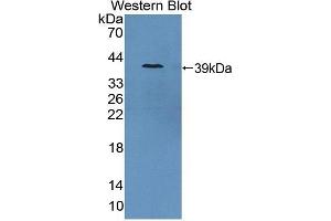 Detection of Recombinant GCPII, Porcine using Polyclonal Antibody to Prostate-specific Membrane Antigen (PMSA) (PSMA antibody  (AA 275-588))