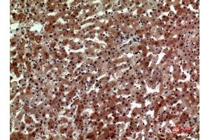 Immunohistochemistry (IHC) analysis of paraffin-embedded Human Liver, antibody was diluted at 1:100. (CD163L1 antibody  (Internal Region))