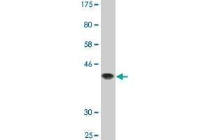 Western Blot detection against Immunogen (37. (STAT6 antibody  (AA 694-801))