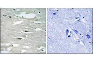 Immunohistochemistry analysis of paraffin-embedded human brain, using ILK (Phospho-Ser246) Antibody. (ILK antibody  (pSer246))
