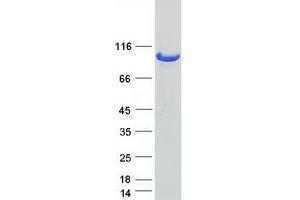 Validation with Western Blot (USP13 Protein (Myc-DYKDDDDK Tag))