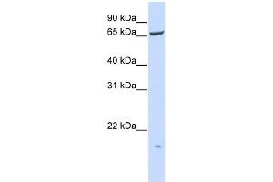 WB Suggested Anti-PIGT Antibody Titration:  0. (PIGT antibody  (N-Term))
