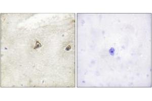 Immunohistochemistry analysis of paraffin-embedded human brain tissue, using c-Abl (Ab-245) Antibody.