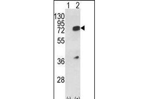 Western blot analysis of HNRPL (arrow) using rabbit polyclonal HNRPL Antibody (Center) (ABIN650774 and ABIN2839554).