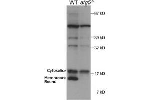 Western blot analysis of autophagic MAP1LC3A in mouse ES cell lysate using MAP1LC3A polyclonal antibody . (MAP1LC3A antibody  (AA 50-150))