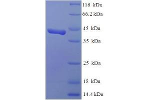 SDS-PAGE (SDS) image for SWI/SNF Related, Matrix Associated, Actin Dependent Regulator of Chromatin, Subfamily C, Member 1 (SMARCC1) (AA 449-669) protein (His-SUMO Tag) (ABIN5711535)