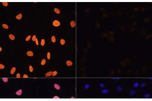 Immunofluorescence analysis of NIH/3T3 cells using Acetyl-Histone H3-K4 Polyclonal Antibody at dilution of 1:100. (Histone 3 antibody  (acLys4))