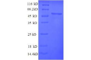 PYDC1 Protein (AA 18-470) (His tag)