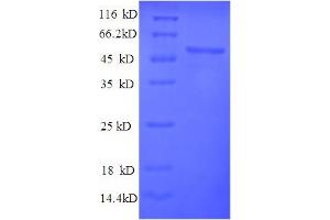 SDS-PAGE (SDS) image for PYD (Pyrin Domain) Containing 1 (PYDC1) (AA 18-470) protein (His tag) (ABIN4977077) (PYDC1 Protein (AA 18-470) (His tag))