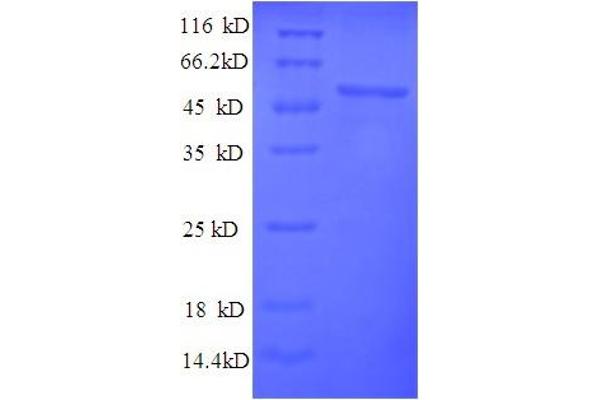 PYDC1 Protein (AA 18-470) (His tag)