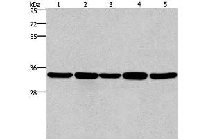 Western Blot analysis of LoVo and A549 cell, Human hepatocellular carcinoma tissue, Jurkat and Hela cell using E2F6 Polyclonal Antibody at dilution of 1:650 (E2F6 antibody)