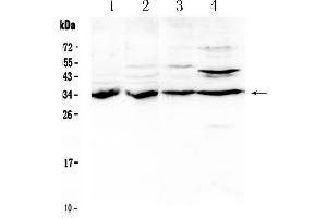 Western blot analysis of BRMS1 using anti- BRMS1 antibody .
