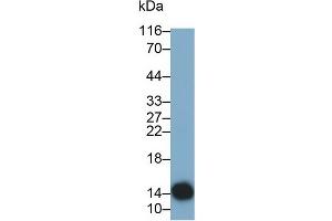 Detection of CST4 in Human Saliva using Monoclonal Antibody to Cystatin 4 (CST4) (CST4 antibody  (AA 21-141))