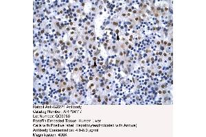 Immunohistochemistry (IHC) image for anti-X-Ray Repair Complementing Defective Repair in Chinese Hamster Cells 6 (XRCC6) (N-Term) antibody (ABIN2778270)