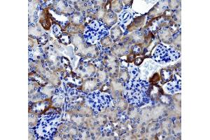 IHC analysis of Ca4 using anti-Ca4 antibody (ABIN7600898).