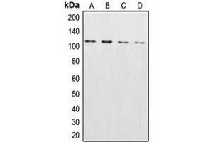 Western blot analysis of XPO2 expression in HeLa (A), NIH3T3 (B), SP2/0 (C), PC12 (D) whole cell lysates. (Exportin 2 antibody  (N-Term))