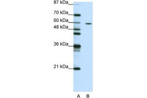 Western Blotting (WB) image for anti-Zinc Finger Protein 382 (ZNF382) antibody (ABIN2461958) (ZNF382 antibody)