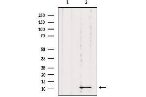 Western blot analysis of extracts from Mouse Myeloma cell, using DYNLRB1 Antibody. (DYNLRB1 antibody  (Internal Region))