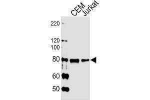 Lane 1: CEM cell lysates, Lane 2: Jurkat cell lysates probed with MYB (1279CT309. (MYB antibody)