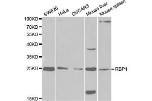 Western blot analysis of extracts of various cell lines, using RBP4 antibody (ABIN5970777) at 1/1000 dilution. (RBP4 antibody)