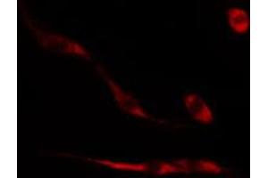ABIN6274494 staining HeLa cells by IF/ICC.