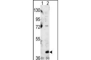 Western blot analysis of P38 (arrow) using P38 Antibody (C-term) (ABIN1882176 and ABIN2841644). (MAPK14 antibody  (C-Term))