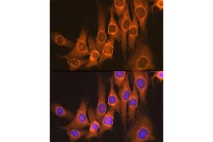 Immunofluorescence analysis of NIH-3T3 cells using Rap1GAP Rabbit mAb (ABIN1680949, ABIN3017895, ABIN3017896 and ABIN7101534) at dilution of 1:100 (40x lens). (RAP1GAP antibody)