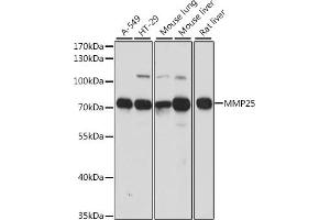 Western blot analysis of extracts of various cell lines, using MMP25 antibody (ABIN7268422) at 1:1000 dilution. (MMP25 antibody  (AA 350-540))
