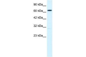 KCNN2 antibody used at 1. (KCNN2 antibody  (C-Term))