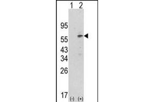 Western blot analysis of PDK1 (arrow) using rabbit polyclonal hPDK1-G14 (ABIN391036 and ABIN2841202). (PDPK1 antibody  (N-Term))
