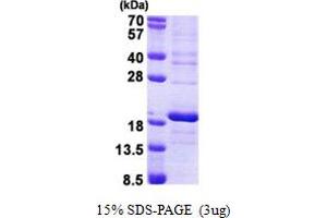 SDS-PAGE (SDS) image for Ribosomal Protein S16 (RPS16) (AA 1-146) protein (His tag) (ABIN7280351) (RPS16 Protein (AA 1-146) (His tag))