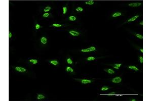 Immunofluorescence of monoclonal antibody to OXSR1 on HeLa cell. (OXSR1 antibody  (AA 351-450))