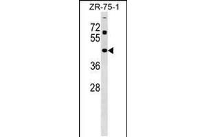 Western blot analysis in ZR-75-1 cell line lysates (35ug/lane). (Zinc Finger and SCAN Domain Containing 31 (ZSCAN31) (AA 190-217) antibody)