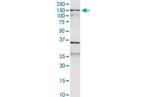 WDHD1 monoclonal antibody (M01), clone 2F10. (WDHD1 antibody  (AA 1031-1128))