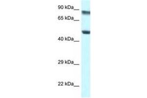 Image no. 1 for anti-Pseudouridylate Synthase 1 (PUS1) (AA 88-137) antibody (ABIN6747496) (PUS1 antibody  (AA 88-137))