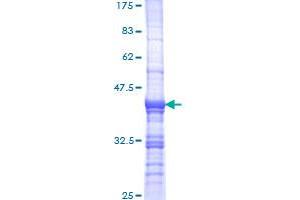 InaD-Like (INADL) (AA 545-651) protein (GST tag)