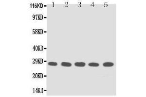 Anti-TFPI2 antibody, Western blotting Lane 1: MM453 Cell Lysate Lane 2: MM231 Cell Lysate Lane 3: HELA Cell Lysate Lane 4:  Cell Lysate Lane 5: JURKAT Cell Lysate