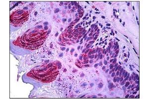 Human Squamous Epithelium: Formalin-Fixed, Paraffin-Embedded (FFPE) (TSPO antibody  (C-Term))