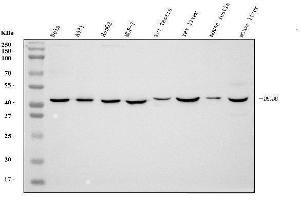Western blot analysis of DHODH using anti-DHODH antibody (ABIN7603140).